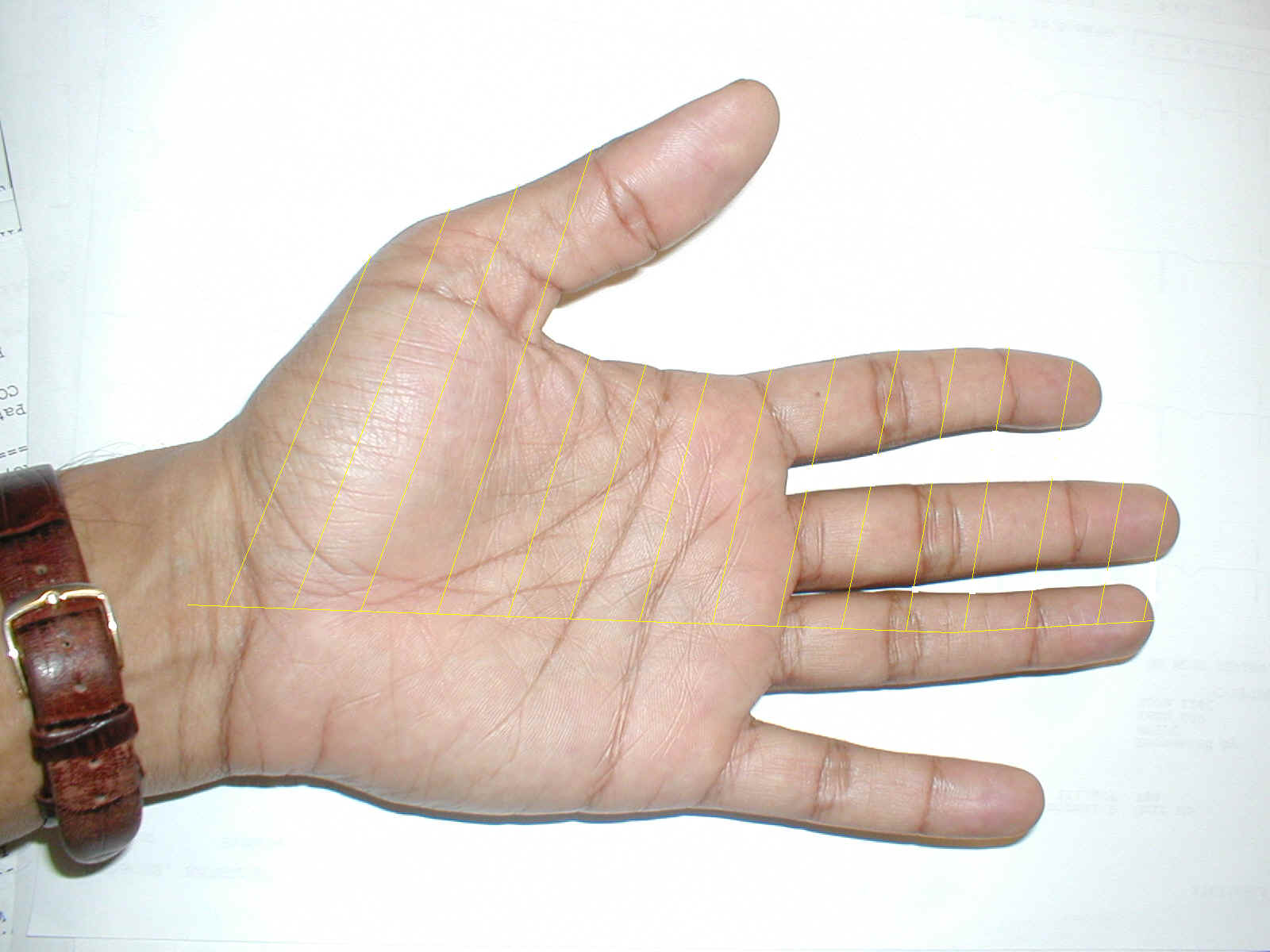 carpaltunnel.jpg (112129 bytes)