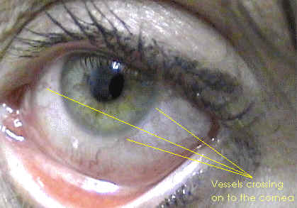 wpeE.jpg (3697 bytes)